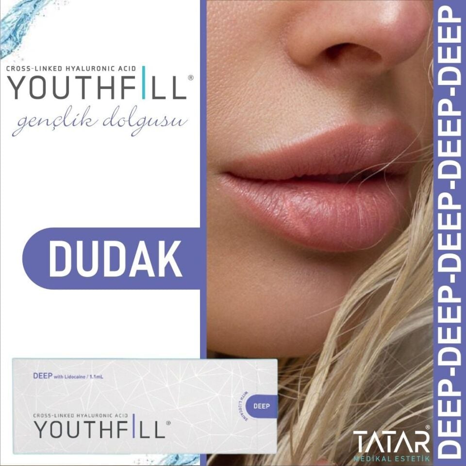 Youthfill Deep Dermal Dolgu